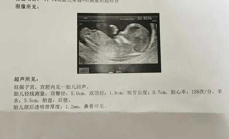 东莞妇幼保健院试管婴儿费用参考？